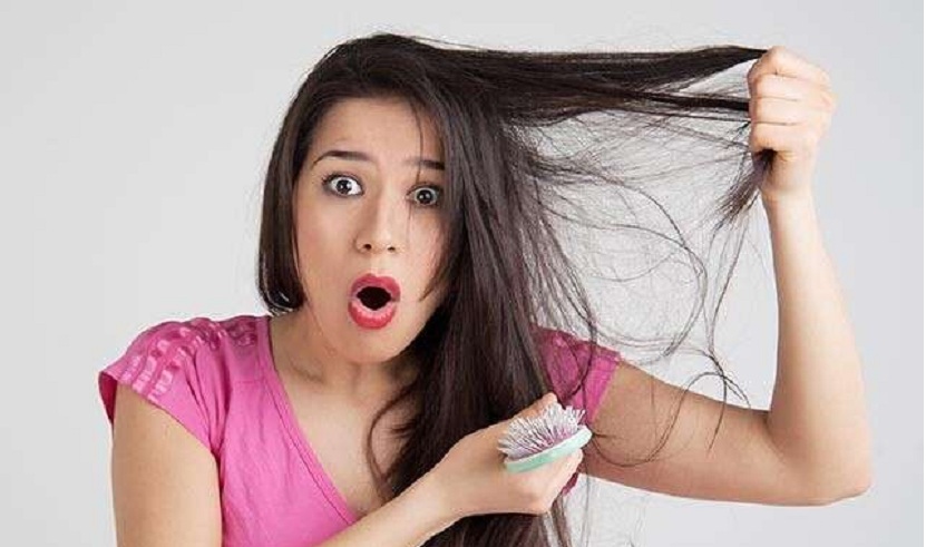 कपाल झरेर हैरान हुनुहुन्छ ? अब यसो गर्नुहोस्