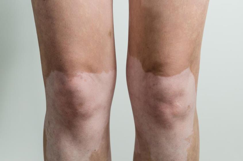 यी खानेकुरा मिसाएर खाँदा हुन सक्छ गम्भीर समस्या