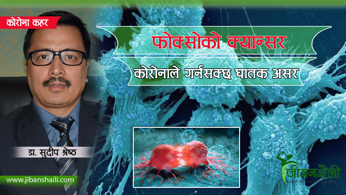फोक्सोको क्यान्सर भएकालाई कोरोनाको जोखिम उच्च